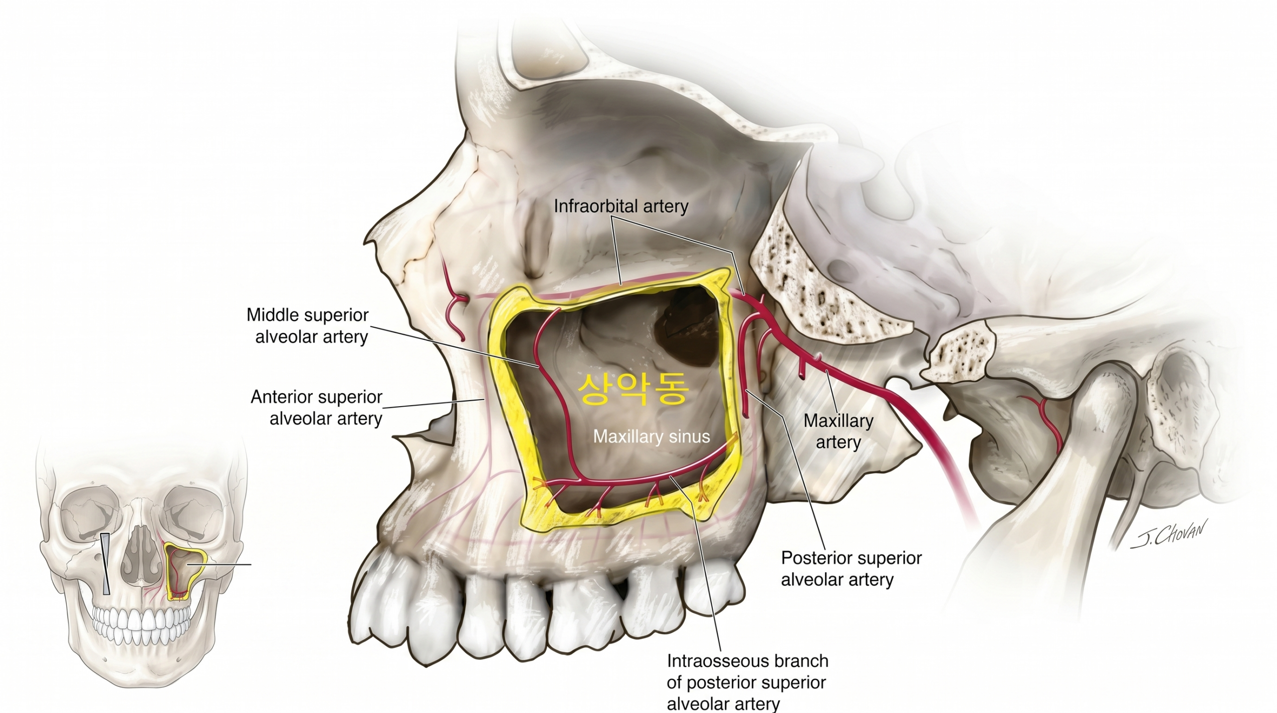 seoulinplant maxillary sinus anatomy xray
